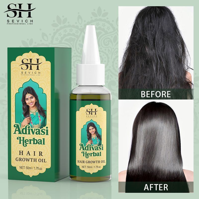 Ayurvedic & Herbal Wellness Kits - น้ำมันบำรุงผมอายุรเวท อินเดีย อะดิวาซี ออร์แกนิค เซรั่มปลูกผม ป้องกันผมร่วง