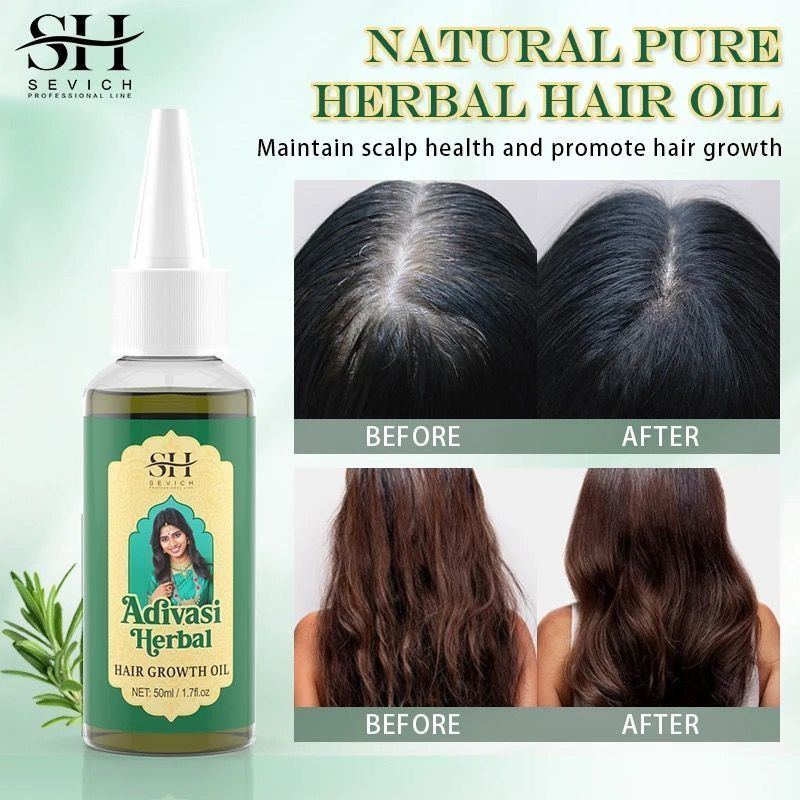 น้ำมันบำรุงผมอายุรเวท อินเดีย  - Ayurvedic & Herbal Wellness Kits บทวิจารณ์และราคา
