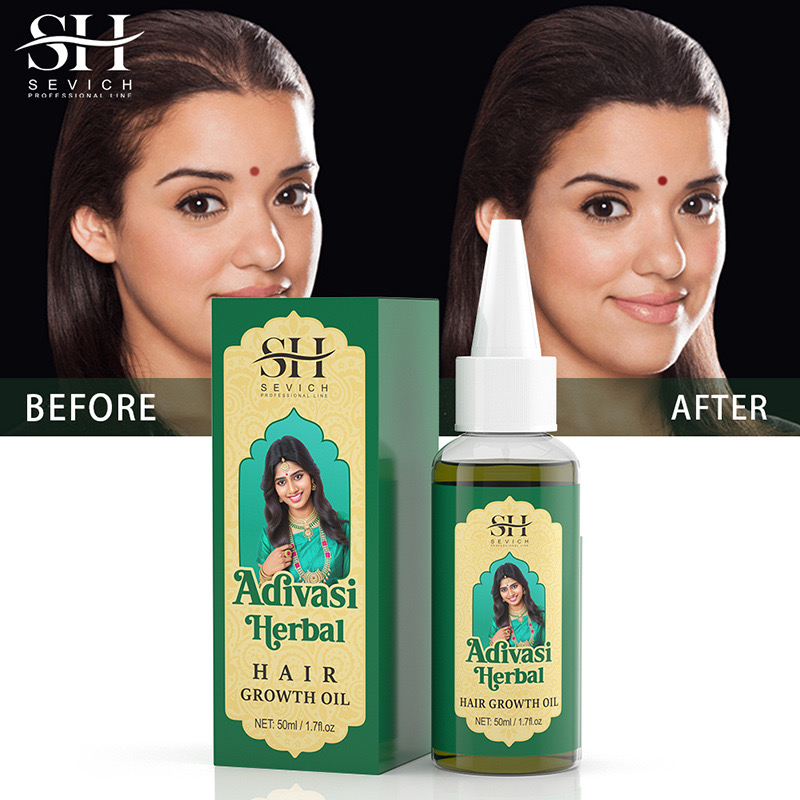 50มล. น้ำมันอินเดียแท้ adivasi - Ayurvedic & Herbal Wellness Kits บทวิจารณ์และราคา